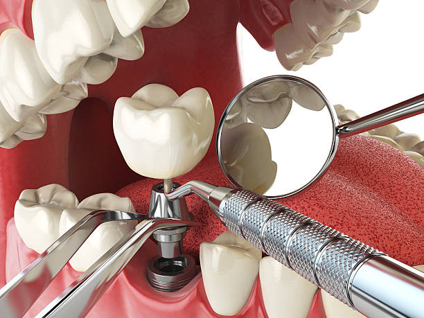 Best Emergency Cosmetic Dentistry in Westchester, FL